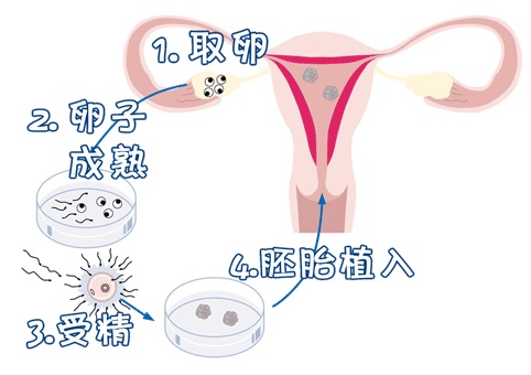 冷冻储存